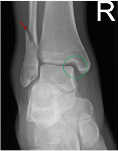 Ankle Medical Check Up